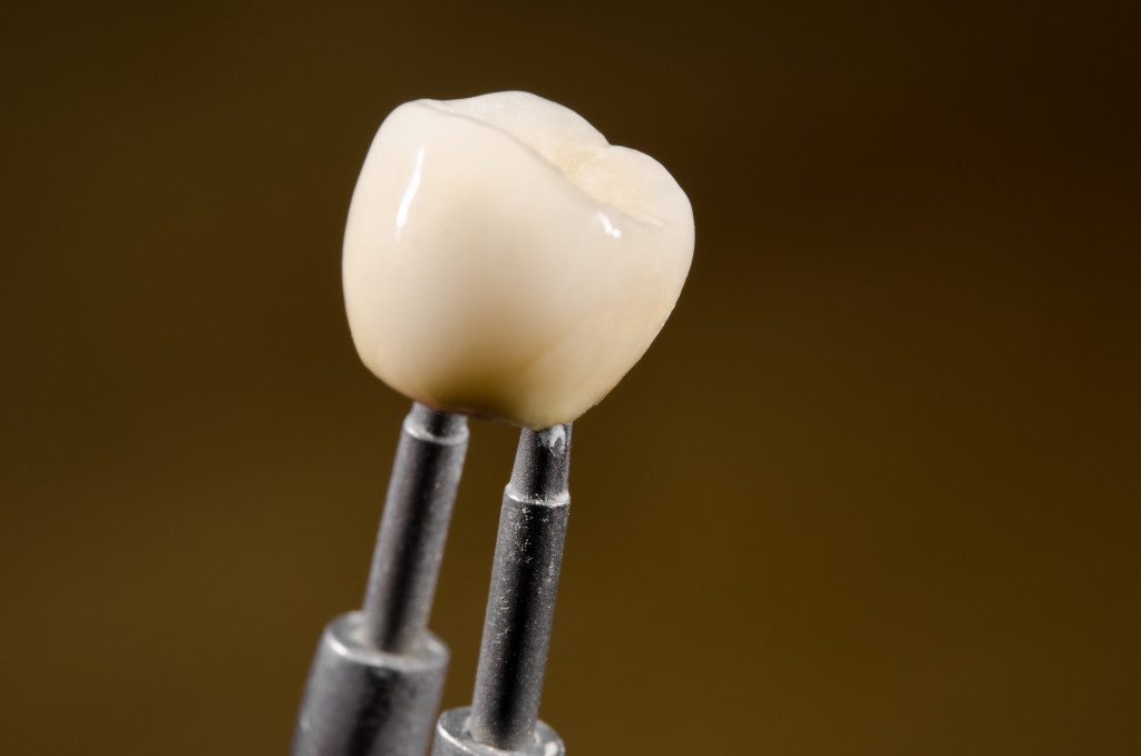 A dental implant held by tweezers