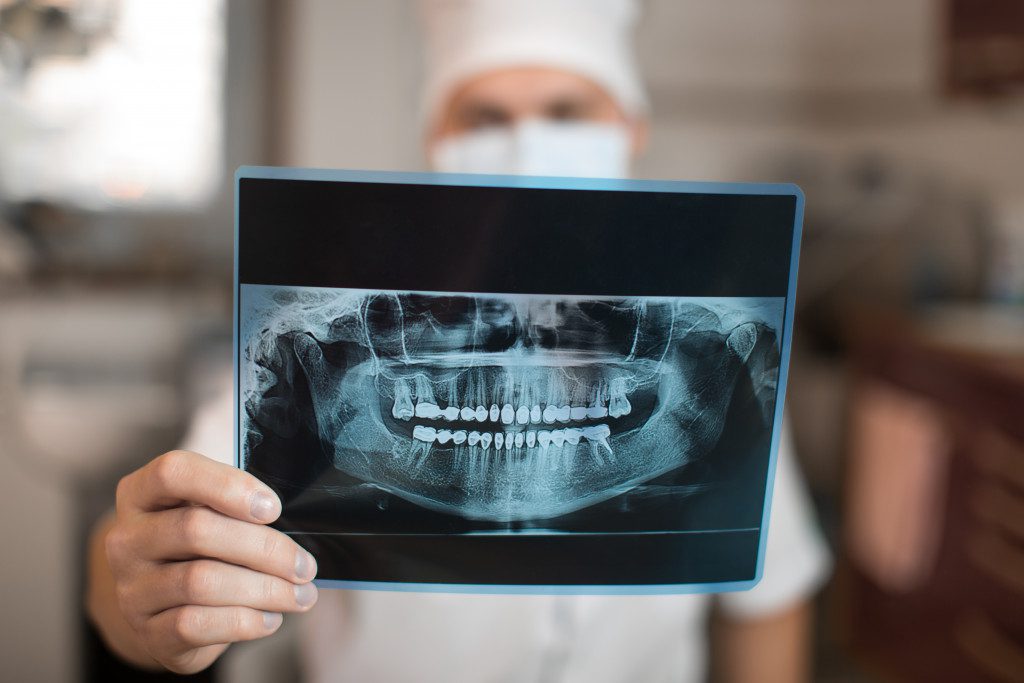 Dentist holding digital X-ray of patient teeth 